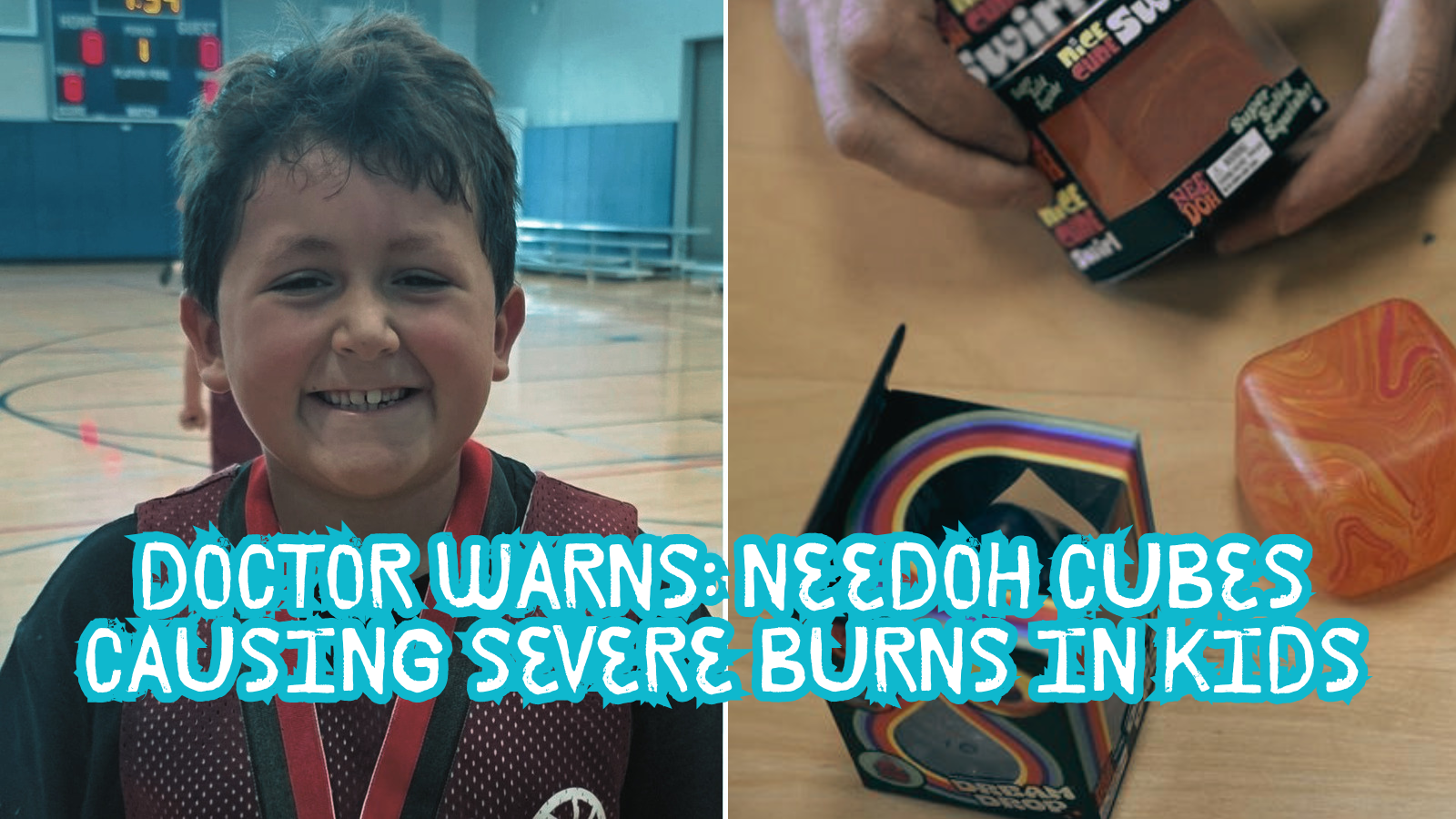 Read more about the article Doctors Issue Urgent Warning: Popular NeeDoh Squishy Toys Linked to Severe Burns, Hospitalizations, and Life-Altering Injuries in Children