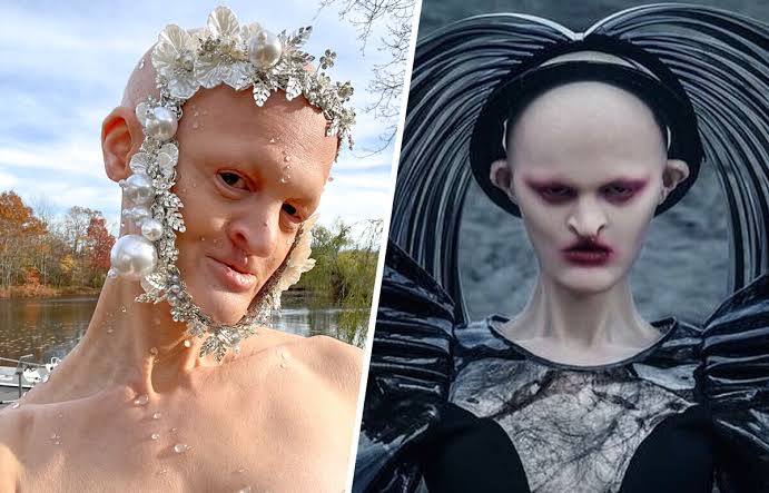 Read more about the article Model Born With Rare Genetic Disorder Is Rewriting Beauty Standards: The Full Inspiring Story of Melanie Gaydos